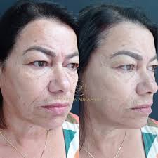 Daniela Abrantes (@dradani.abrantes) • Instagram photos and videos