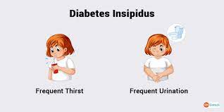 Diabetes insipidus occurs when your body can't properly balance the body's fluid levels. What Are The Symptoms Of Diabetes Insipidus Di Gomedii