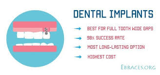 Teeth gap bands to correct gap teeth may outwardly produce a healthy smile. How To Fix Gaps In Teeth These 7 Best Non Painful Ways