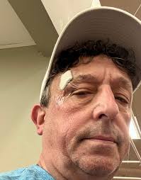 How not to spend your day off… I walked into a pole by accident in ShopRite  this afternoon, breaking my sunglasses which in turn stabbed me above my  right eye. Thank goodness