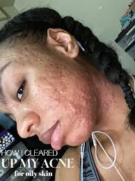 Transforming my skincare journey with Susenji Luna