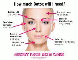 Image Result For Botox Injection Sites Diagram Botox