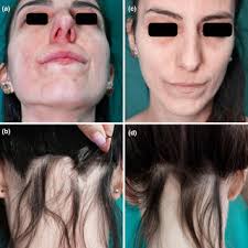 Alessandra CHIEI GALLO