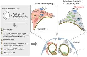 Zimnitsky's test characterize condition of renal concentrating. Jci Insight C3a Receptor Blockade Protects Podocytes From Injury In Diabetic Nephropathy