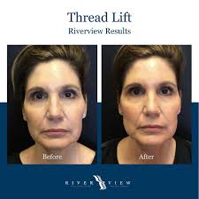 Riverview Facial Plastic Surgery