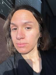 Riman Products for Sensitive Skin and Chronic Comorbidities