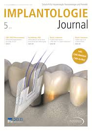 We did not find results for: Ij0519