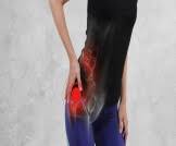 كيس الشعر أسباب وأعراض وعلاج ويب طب