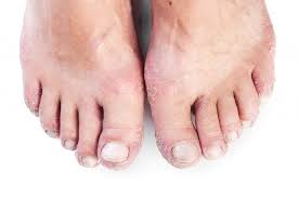 Pin On All About Feet