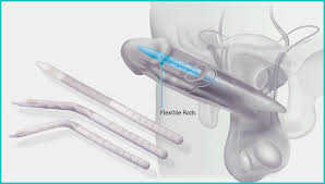Image result for Penile Prosthesis