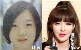 Idols Bad Plastic Surgery Allkpop Forums