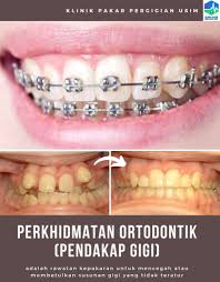 Maybe you would like to learn more about one of these? Baik Buruk Rawatan Braces Pendakap Gigi Majalahsains