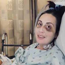 Fundraiser for Calvin Lorenz by Elizabeth Damon : Support Anna's Recovery  from Terrible Accident