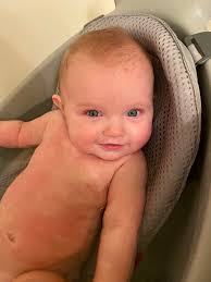 Kia ora, my son (2 years old) has developed terrible face eczema in the  last few months. It's very stubborn and isn't really getting any better  with steroid and cetomacrogol. Has anyone