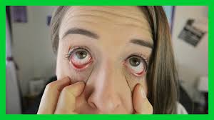 Luckily, there are things you can do to help improve your blind dog's quality of life. I M Going Blind Youtube