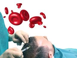 Stem cell treatment for hair loss philippines it's been theorised for years, but now human stem … cells and confirmed their ability to induce hair growth when. Stem Cell Therapy For Hair Loss Potential And Limitations Hairverse