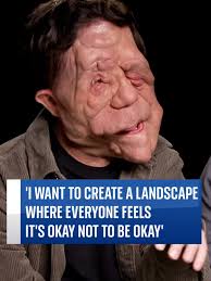 #Actor and #campaigner #AdamPearsontalks to #SkyNews' Debbie Ridgard ahead  of his new psychological #thriller #ADifferentMan featuring #SebastianStan