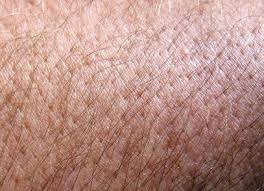 This spot evolves and changes quickly. Skin Signs Of Lung Cancer 2bstronger Com