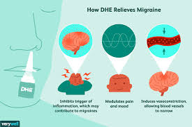 Dihydroergotamine Dhe For Migraines