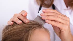 How do health care professionals diagnose scalp psoriasis? Diagnosing Scalp Psoriasis What Doctors Look For Wrcbtv Com Chattanooga News Weather Amp Sports