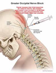Pin On Cervical Anatomy
