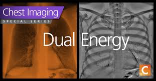 In fact every radiologst should be an expert in chest film reading. Dose Efficient Dual Energy The New Standard In Chest X Rays Everything Rad