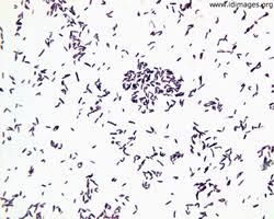 Image result for Corynebacterium