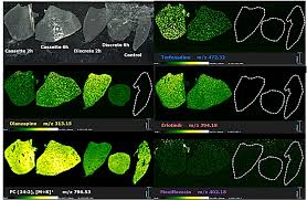 DESI: MS Imaging for Biomedical Research