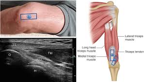 Image result for Elbow Injection