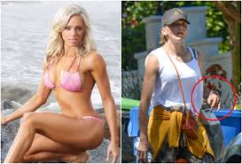 Ex-modelo Loni Willison vasculha lixo e dedos deformados chamam atenção; veja fotos