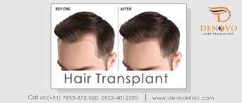 Royal canin hair and skin care 2 kg kedi mama hassas deri kepek mat tüyler ve deri tahrişi önleme. Best Skin Clinic In Lucknow Hair Fall Treatment In Lucknow