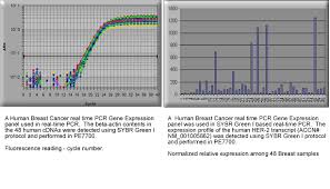 I know this might make me sound crazier than a crazy cat lady, but, i think my cat might be able detect cancer. Tissuescan Breast Cancer Cdna Array Ii Bcrt102 Origene