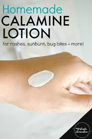 Homemade Calamine Lotion For Rashes Sunburn Bug Bites More My Darla Clementine Calamine Lotion Homemade Calamine Lotion Bug Bites Remedies