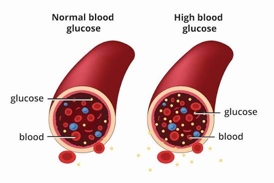 Insulin Sensitivity
