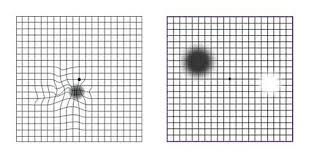 Amsler Grid How To Monitor Yourself For Macular Degeneration