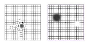 amsler grid how to monitor yourself for macular degeneration