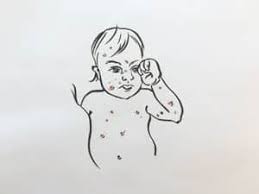 Och så har jag de geografiska jag skulle bli väldigt tacksam om du ville hjälpa mig ta ett bra beslut om kosttillskott till vårt barn. Blasor I Munnen Hos Barn Barnakuten Nu