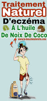 Traitement Naturel D Eczema A L Huile De Noix De Coco Eczema Huile De Coco Peau Remede Eczema