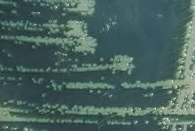 Image result for yersinia fotos