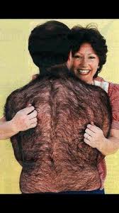 I was not forewarned about either possible side effects. 84 Laser Hair Removal Signs Ideas Laser Hair Removal Hair Removal Laser Hair