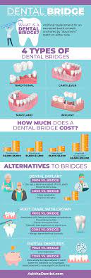 Estimates should not be construed as financial or medical advice. Do You Need A Dental Bridge 4 Types Cost Uses Alternatives