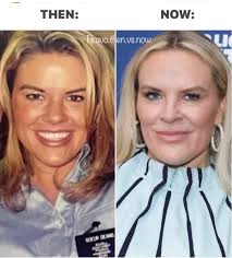 Heather Gay's transformation and femininity after plastic surgery