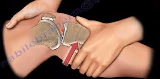 Image result for Lachman Test