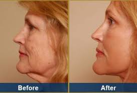 Clinique Plastic Surgery