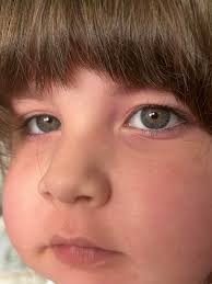 Can someone plz remove that stray hair in her face?