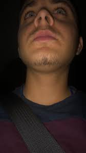 Maybe you would like to learn more about one of these? 22 Years Old Can Only Grow Facial Hair On Chin And Upper Lip 2 Weeks Without Shaving My Dad Has A Full Beard But He Is In His Sixties Also I Was