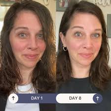 Thank you Sharmin Khan for your video. Although these are my first I like  the results. Nowhere near hers but Im new 😊 I can't believe what's  happening with the cells.