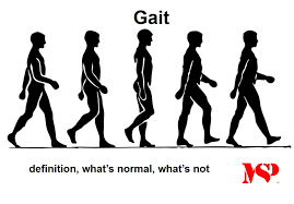 Image result for Gait