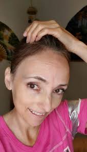 Not the best pic with lighting but my hair is definitely improving with the  protein and supplements. Now I've kicked it up a notch and (not so)  patiently waiting for my trio