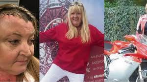 Brain tumour mum turned away by doctors TEN times and told it was just the  menopause